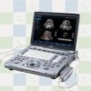 voluson i portable