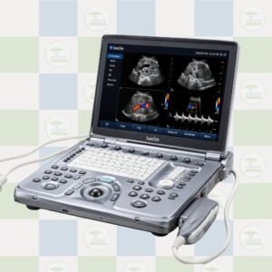 voluson i portable